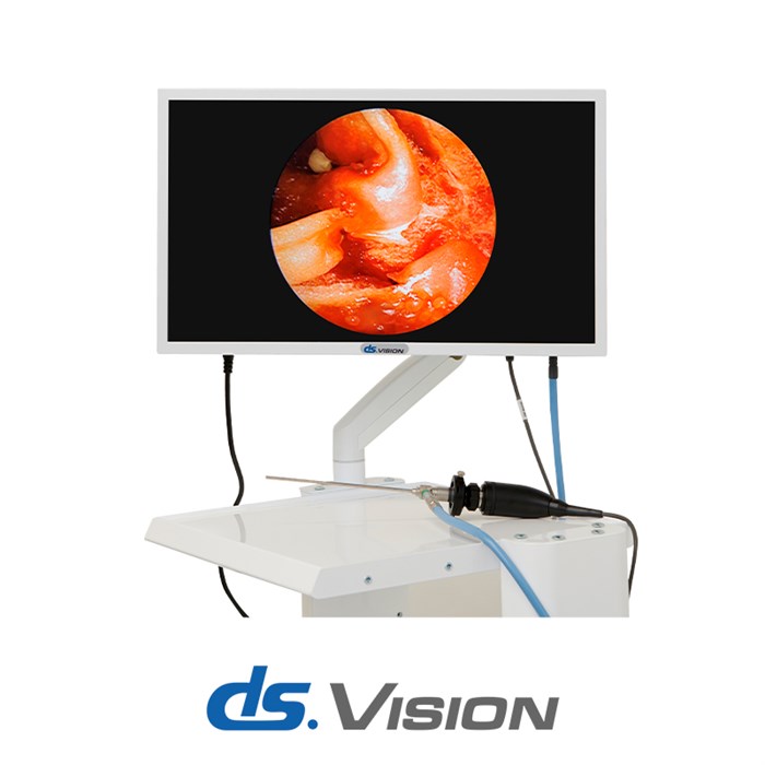 Система эндоскопической визуализации DS.Vision FHD 3in1 10216
